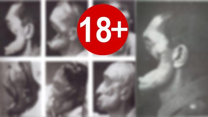 Çanakkale Savaşı’nda Yüzü Parçalanan Türk Asker ile Ona Yüz Estetiği Yapan Alman Doktorun Çarpıcı Hikâyesi