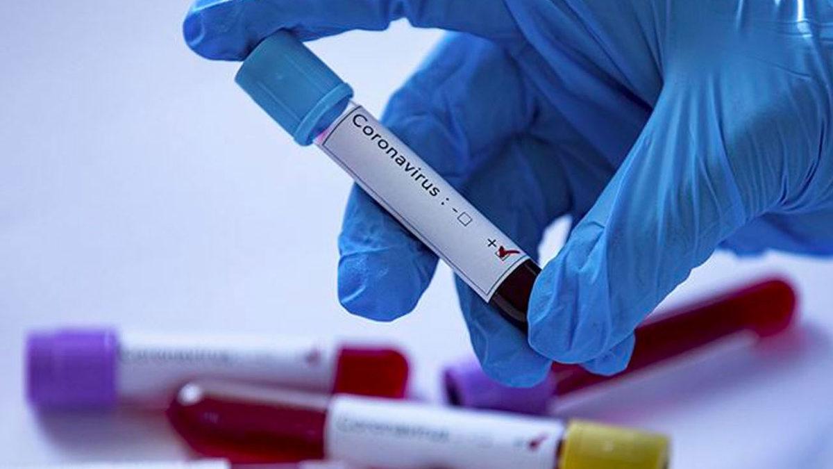 Bilim Kurulu Üyesi, Kan Grubunun Koronavirüsten Koruyucu Bir Yanının Olmadığını Açıkladı