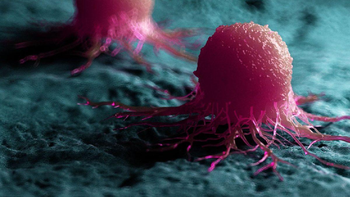 Kanserin Yayılmasını Engellemek Mümkün Olabilir: Kanserli Hücrelerin Nasıl Yıllarca Uykuda Kaldığı Keşfedildi