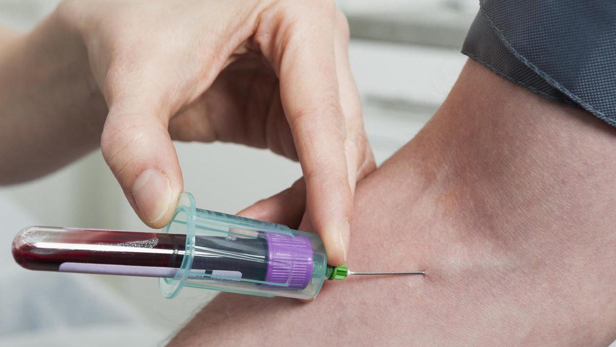 COVID-19 Hastalarının Yoğun Bakıma İhtiyaç Duyup Duymayacağını Öngören Kan Testi Geliştirildi