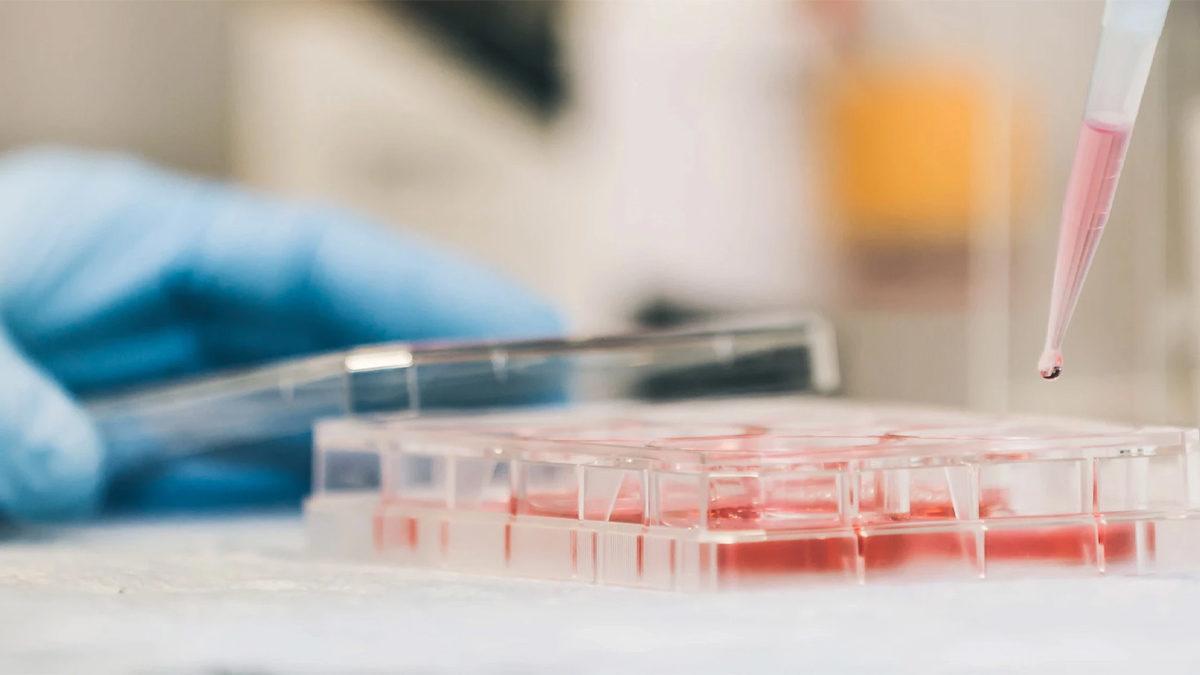 COVID-19 Hastalarının Yoğun Bakıma İhtiyaç Duyup Duymayacağını Öngören Kan Testi Geliştirildi