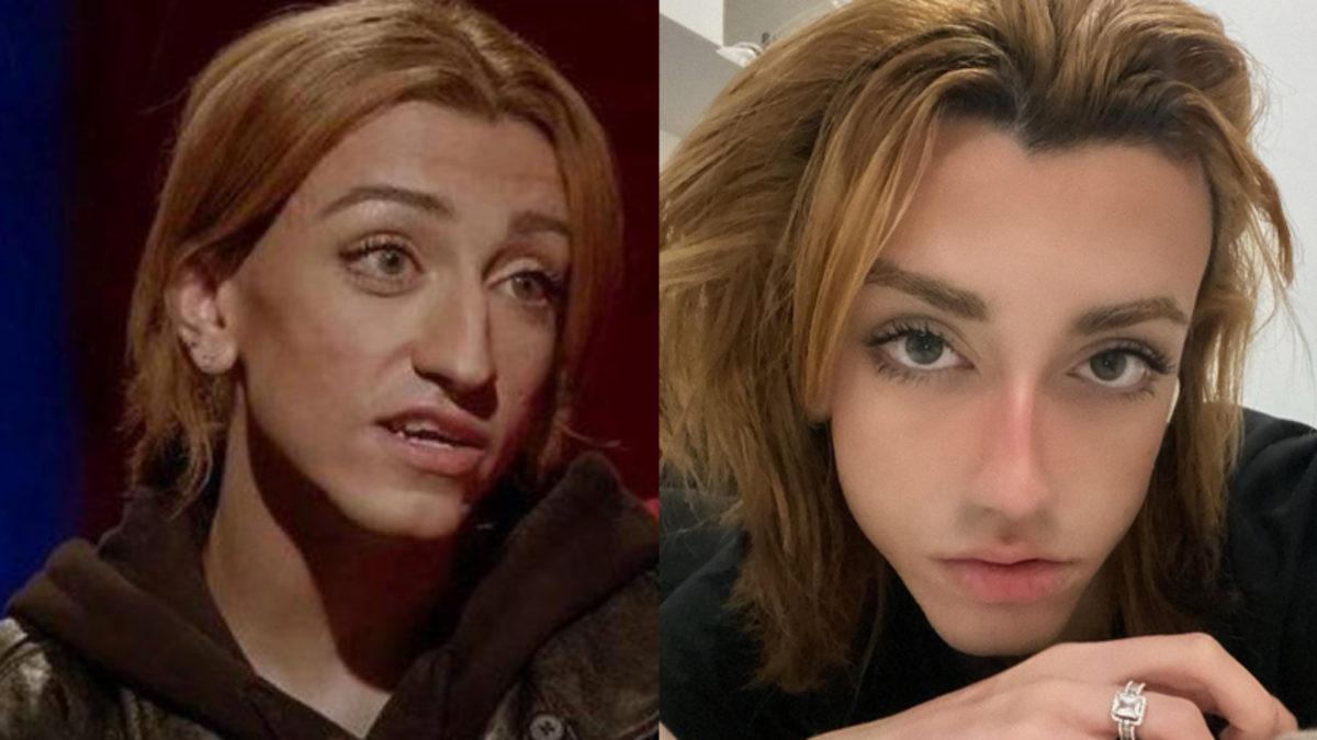 Estetik Operasyon Geçiren TikTok Fenomeni Mika Raun Bambaşka Biri Oldu: Tepkiler Tam Tahmin Ettiğiniz Gibi...