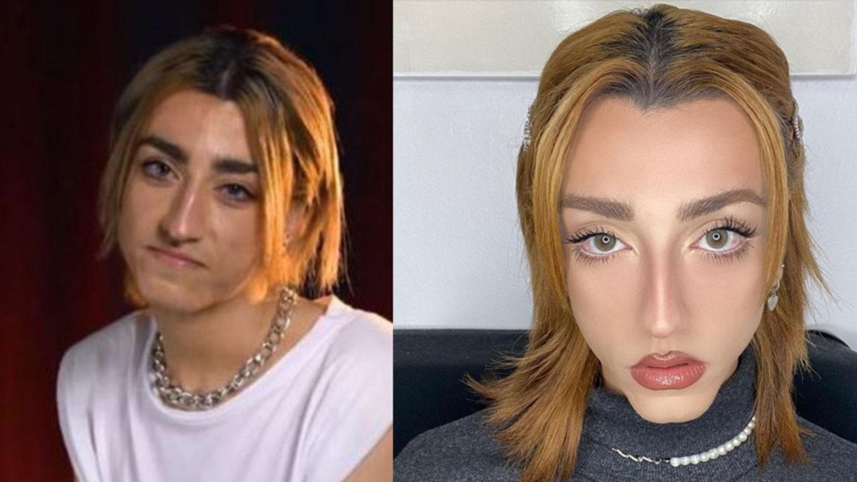 Estetik Operasyon Geçiren TikTok Fenomeni Mika Raun Bambaşka Biri Oldu: Tepkiler Tam Tahmin Ettiğiniz Gibi...