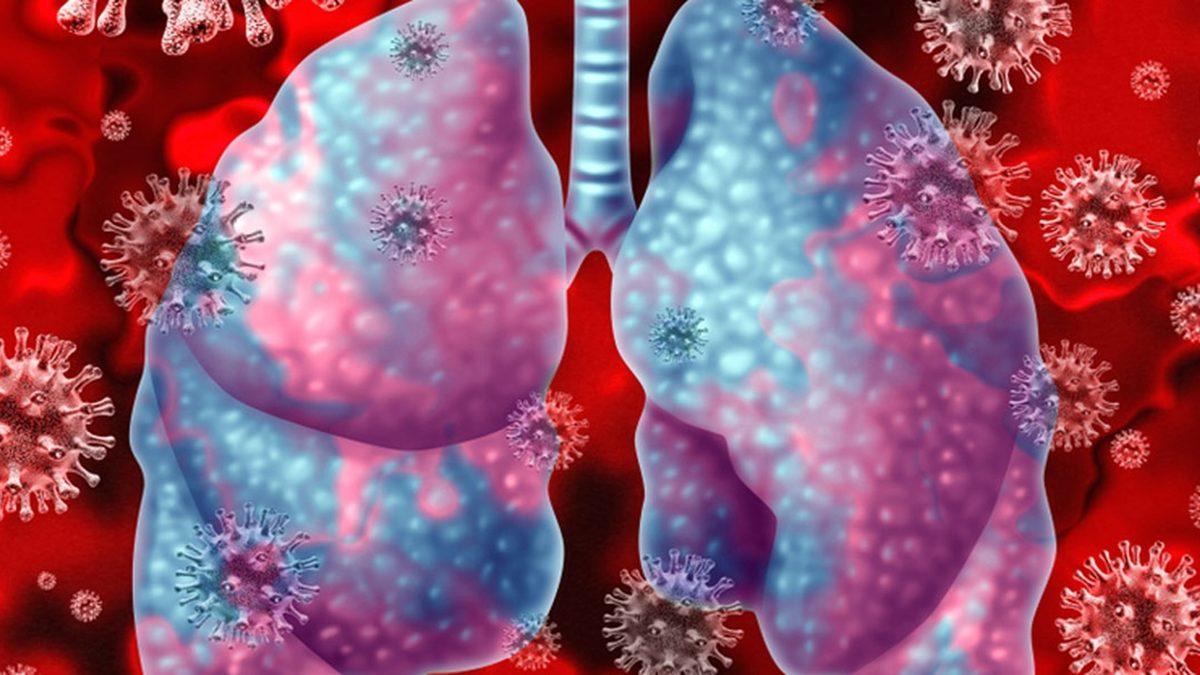 Hepimizi Canından Bezdiren Pandemi Bu Yaz Biter mi, Yoksa Yıllarca Sürer mi? Uzmanların Görüşlerini Derledik