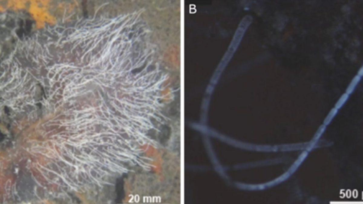 Bilim İnsanları ’Çıplak Gözle Görülebilen’ En Büyük Bakteri Türünü Keşfetti: Neredeyse Bir Fıstık Büyüklüğünde
