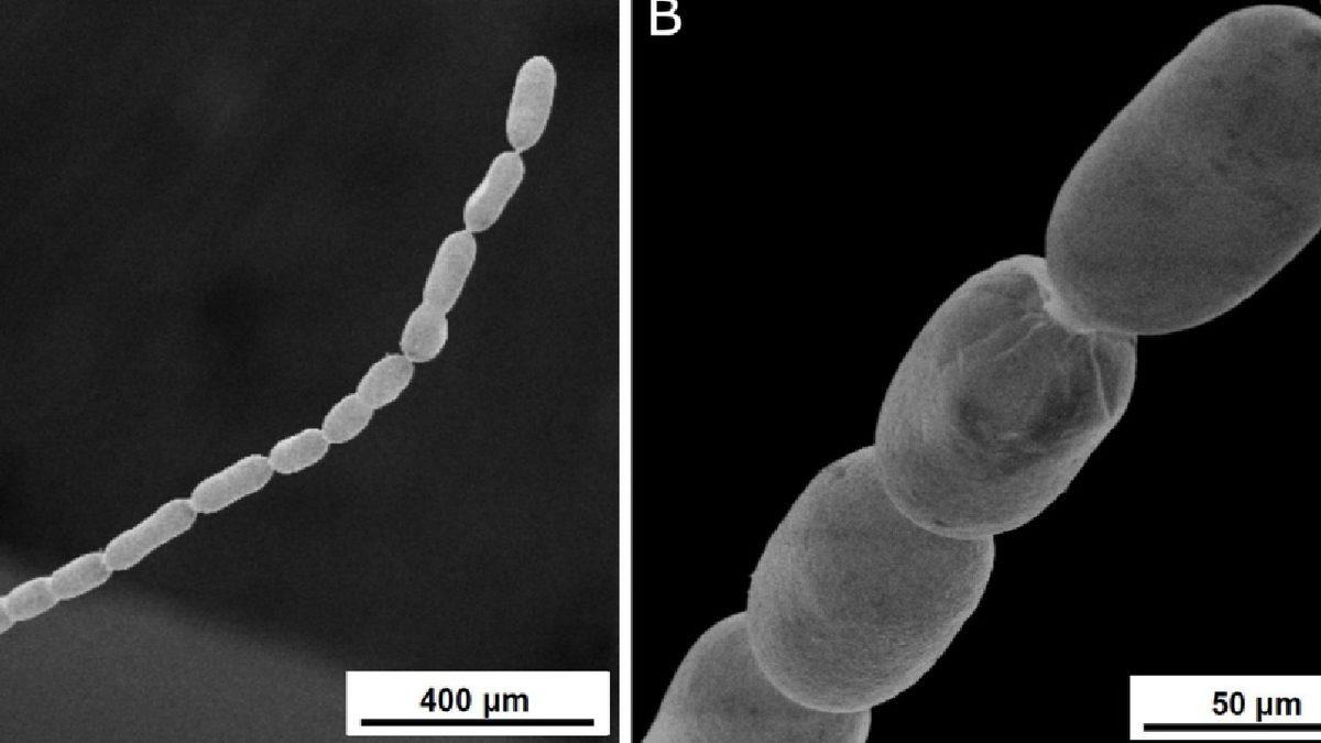 Bilim İnsanları ’Çıplak Gözle Görülebilen’ En Büyük Bakteri Türünü Keşfetti: Neredeyse Bir Fıstık Büyüklüğünde
