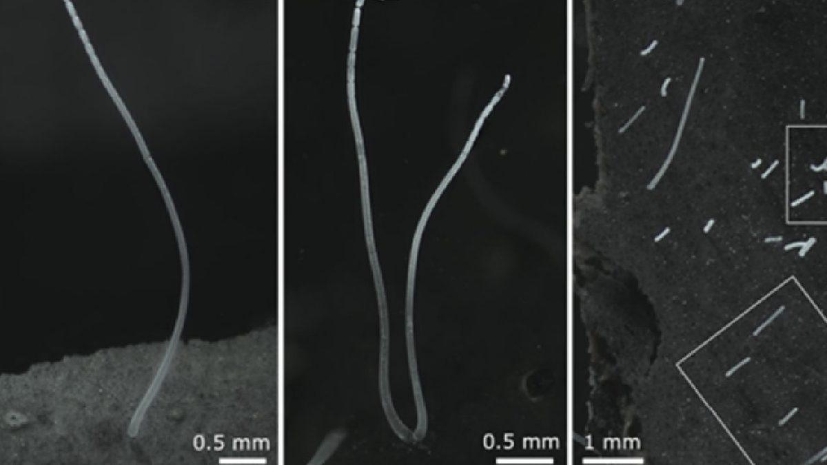 Bilim İnsanları ’Çıplak Gözle Görülebilen’ En Büyük Bakteri Türünü Keşfetti: Neredeyse Bir Fıstık Büyüklüğünde