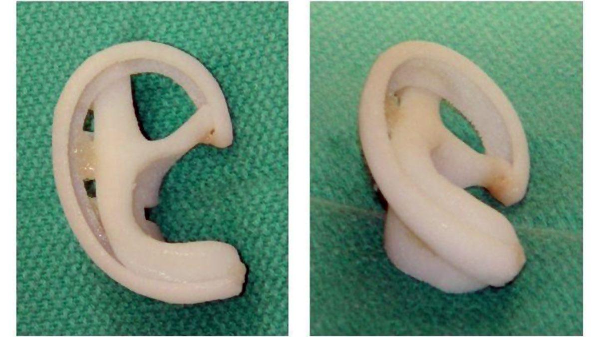 Yaşlı Bir İnsanın Kulakları ve Burnu Neden Gençlik Haline Göre Daha Büyük Olur?