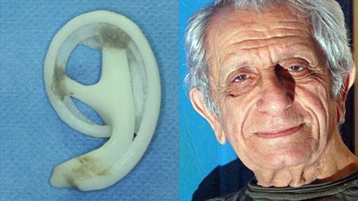 Yaşlı Bir İnsanın Kulakları ve Burnu Neden Gençlik Haline Göre Daha Büyük Olur?