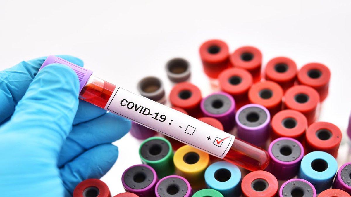 Yapılan Bir Araştırmaya Göre Covid-19’a Karşı Bağışıklık 8 Ay Sürebiliyor