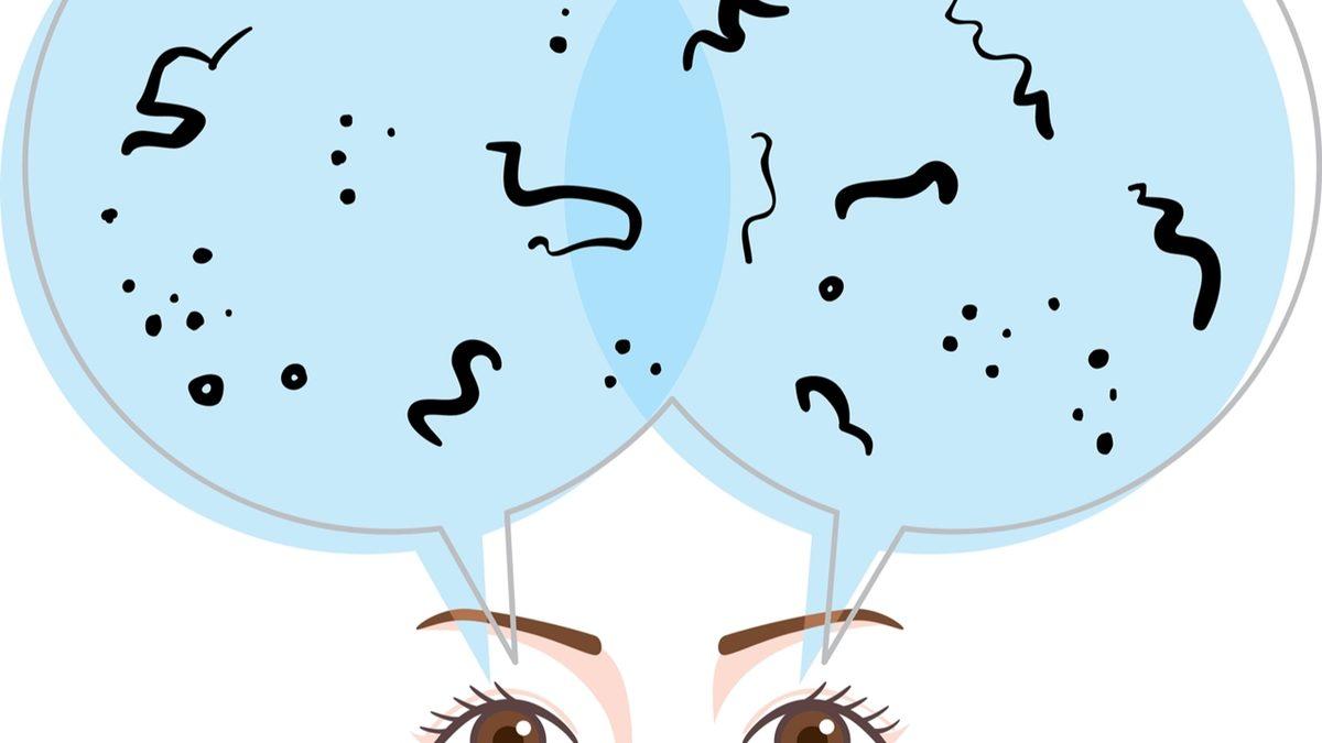 Gözümüzün Önünde Uçuşan Belli Belirsiz Tuhaf Cisimler Neyin Nesidir?