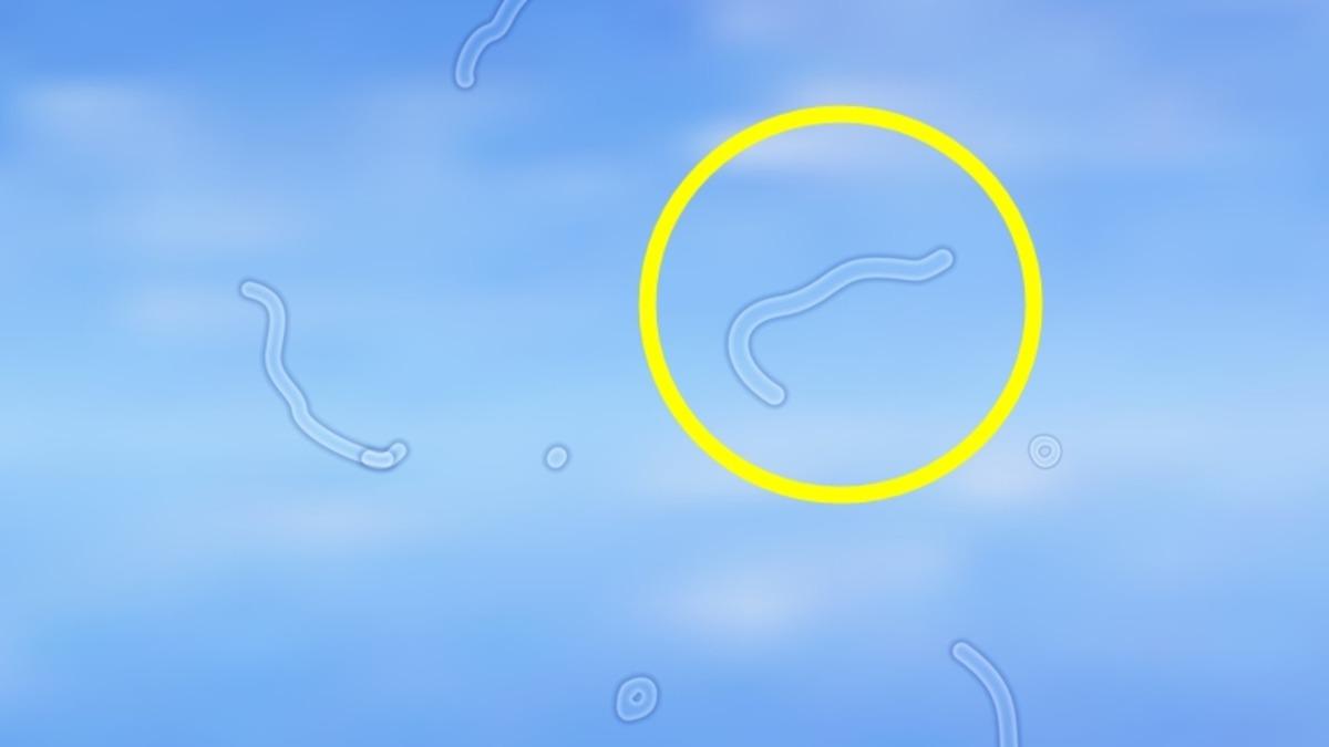 Gözümüzün Önünde Uçuşan Belli Belirsiz Tuhaf Cisimler Neyin Nesidir?