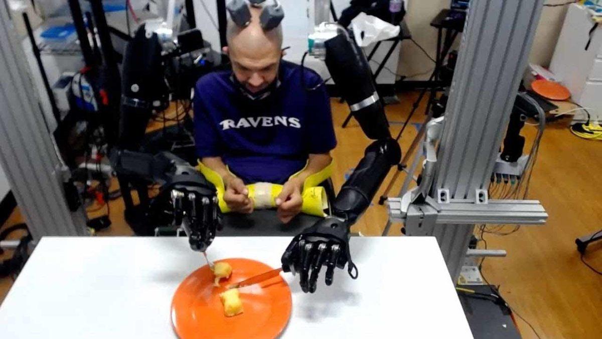 30 Yıldır Felç Olan Bir Adam, Beynine Yerleştirilen Çiplerle Robotik Kol Kullanmaya Başladı