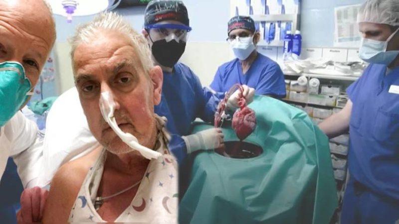 Tarihte Domuz Kalbi Nakledilen İlk İnsan, Ameliyattan İki Ay Sonra Hayatını Kaybetti: Ölüm Nedeni Bilinmiyor