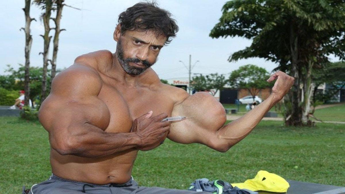 Vücut Geliştirme Sporunun Son Derece Riskli Tarafı: Synthol Nedir, Zararları Nelerdir?