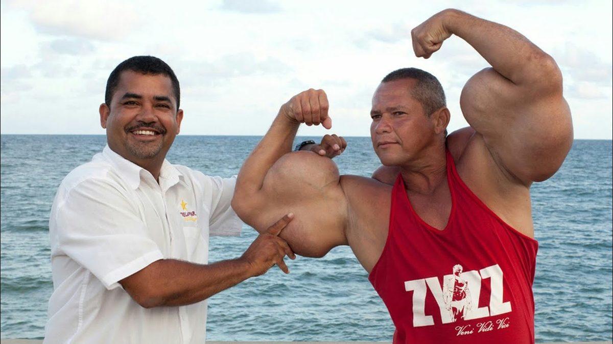 Vücut Geliştirme Sporunun Son Derece Riskli Tarafı: Synthol Nedir, Zararları Nelerdir?