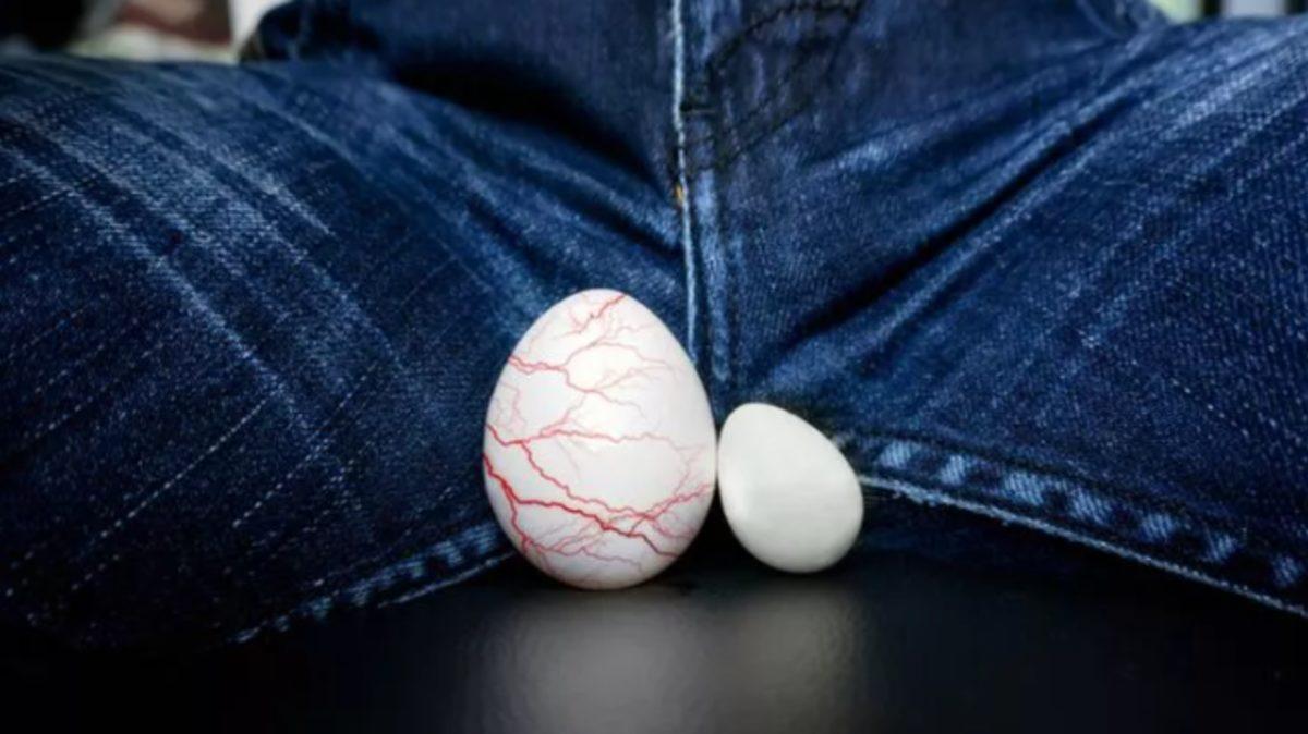 Bilime Göre Sağlıklı Bir Testis Nasıl Görünür, Kendi Kendinize Testis Muayenesini Nasıl Yaparsınız?