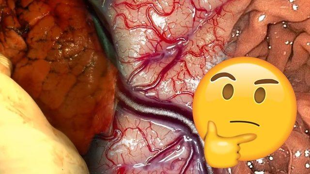 İç Organlarımız Aslında Nasıl Görünür? (En Yakınımızdakileri Tanıyalım)