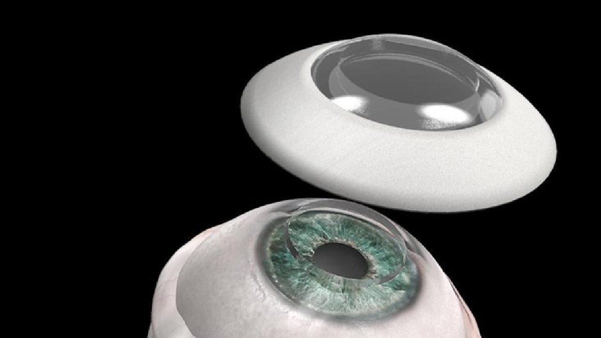 Görme Engelli Bir Adam, Yapay Kornea Sayesinde Tekrar Görmeye Başladı