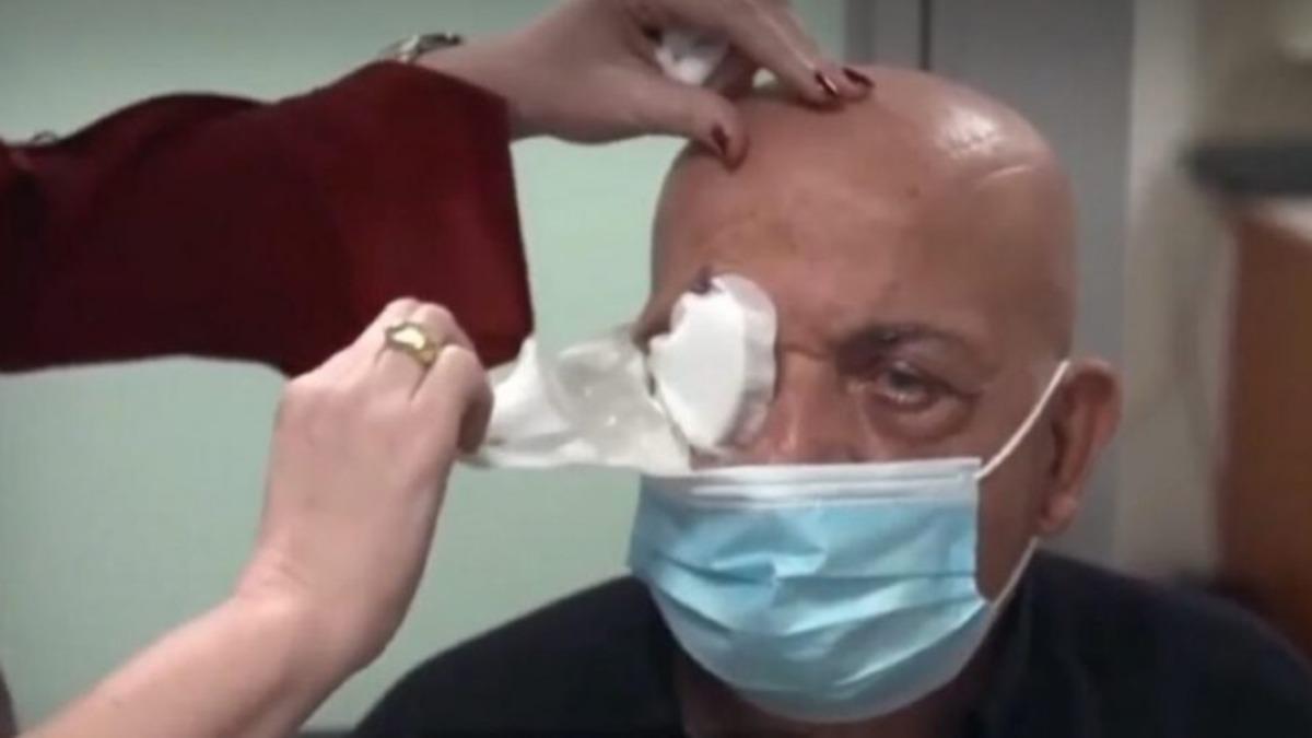 Görme Engelli Bir Adam, Yapay Kornea Sayesinde Tekrar Görmeye Başladı