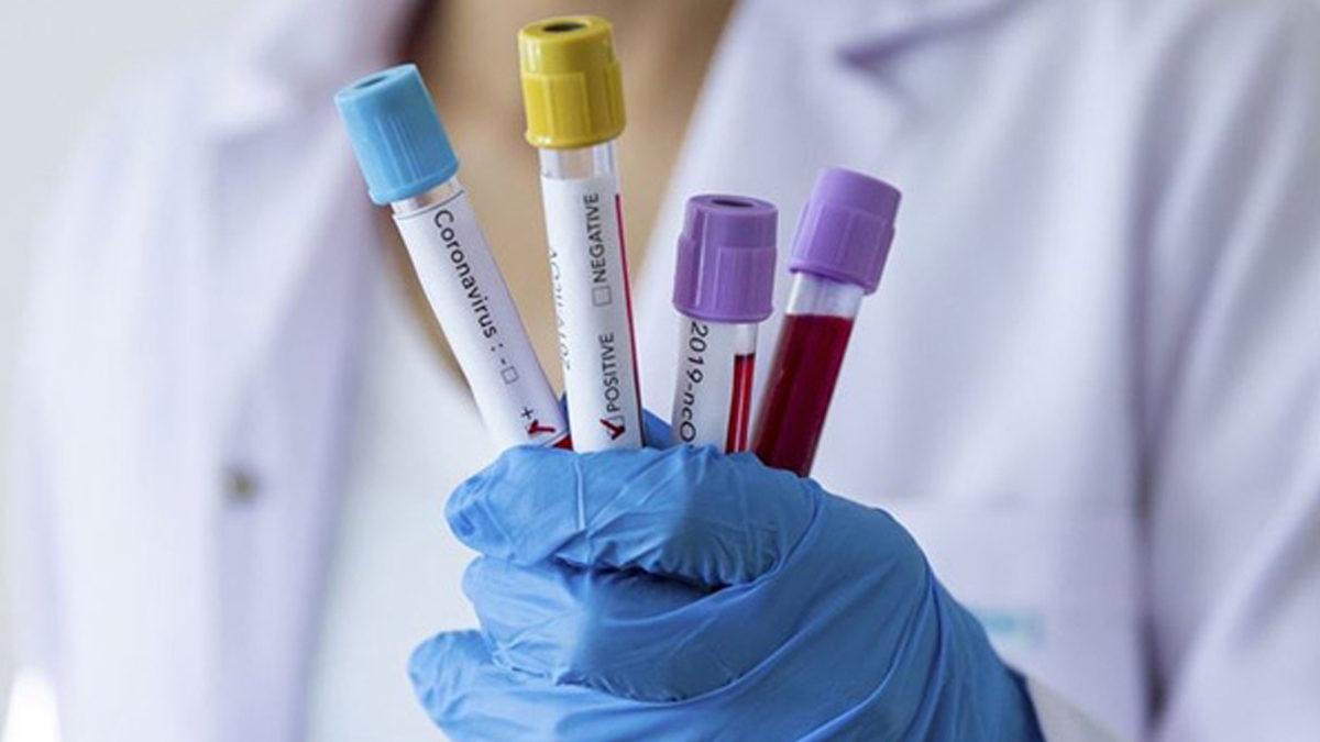 Sağlık Bakanlığı, Dolandırıcıların Yeni Yöntemi Olan ’Aşı Sıranız Geldi’ Mesajlarıyla İlgili Uyarı Yaptı