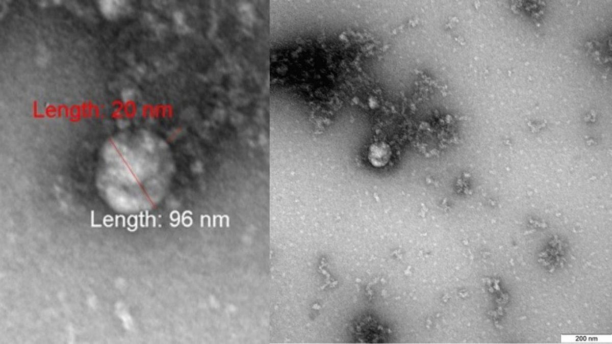 İngiltere’de Ortaya Çıkan Mutant Koronavirüs, İlk Kez Görüntülendi