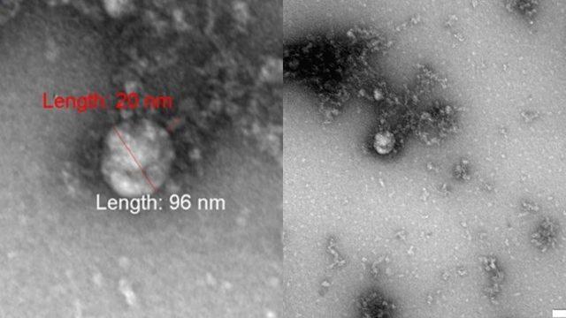 İngiltere’de Ortaya Çıkan Mutant Koronavirüs, İlk Kez Görüntülendi