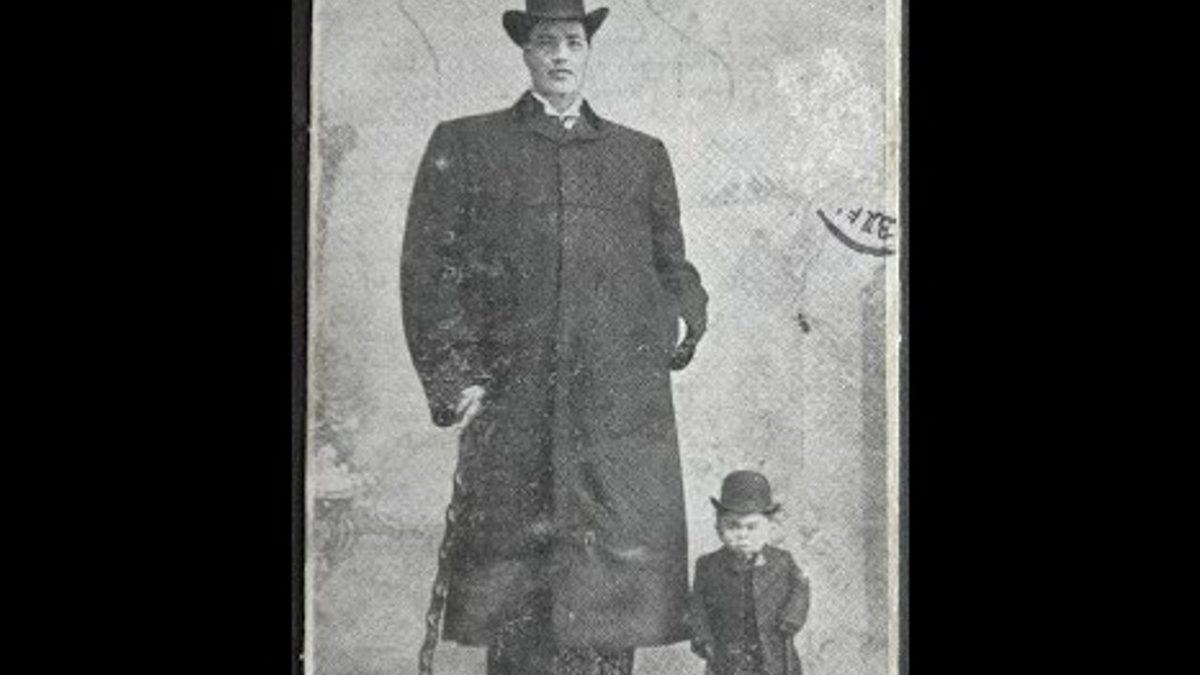 Dünyaya Bir Cüce Olarak Gelip Dev Olarak Yaşamını Yitiren Adam Rainer’ın Şaşkınlık Veren Hikayesi