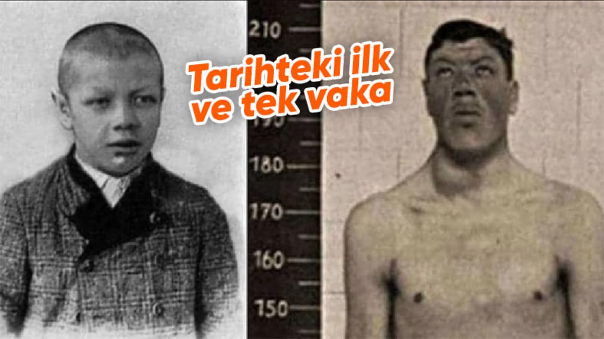 Dünyaya Bir Cüce Olarak Gelip Dev Olarak Yaşamını Yitiren Adam Rainer’ın Şaşkınlık Veren Hikayesi