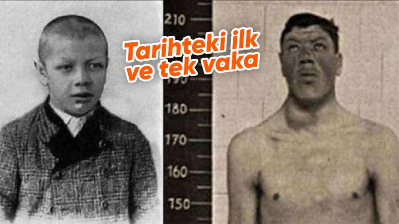 Dünyaya Bir Cüce Olarak Gelip Dev Olarak Yaşamını Yitiren Adam Rainer’ın Şaşkınlık Veren Hikayesi