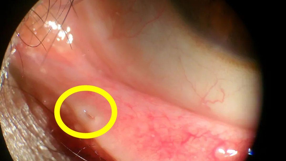 Göz Kapağınızın İç Kısmında Küçük Bir Delik Bulunduğunu Biliyor muydunuz? Peki Ne İşe Yarıyor?