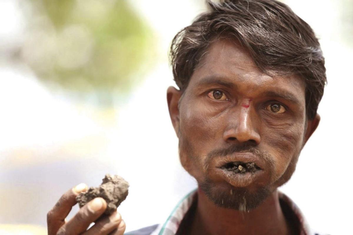 Bazı İnsanların Toprak, Kalem Ucu, Kâğıt Gibi Nesneleri Dişleme Arzusunun Sebebi Nedir?