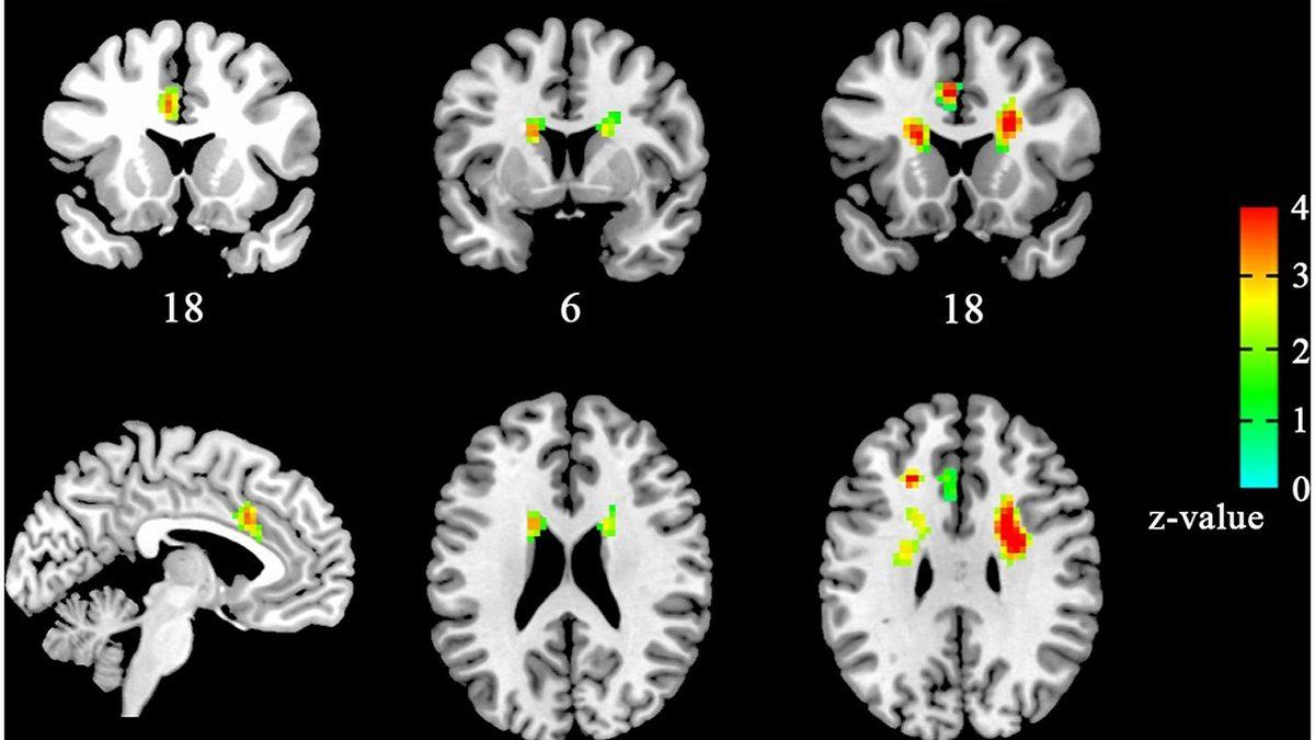 Bilime Göre Aşık Olup Olmadığınızı Nasıl Anlarsınız?