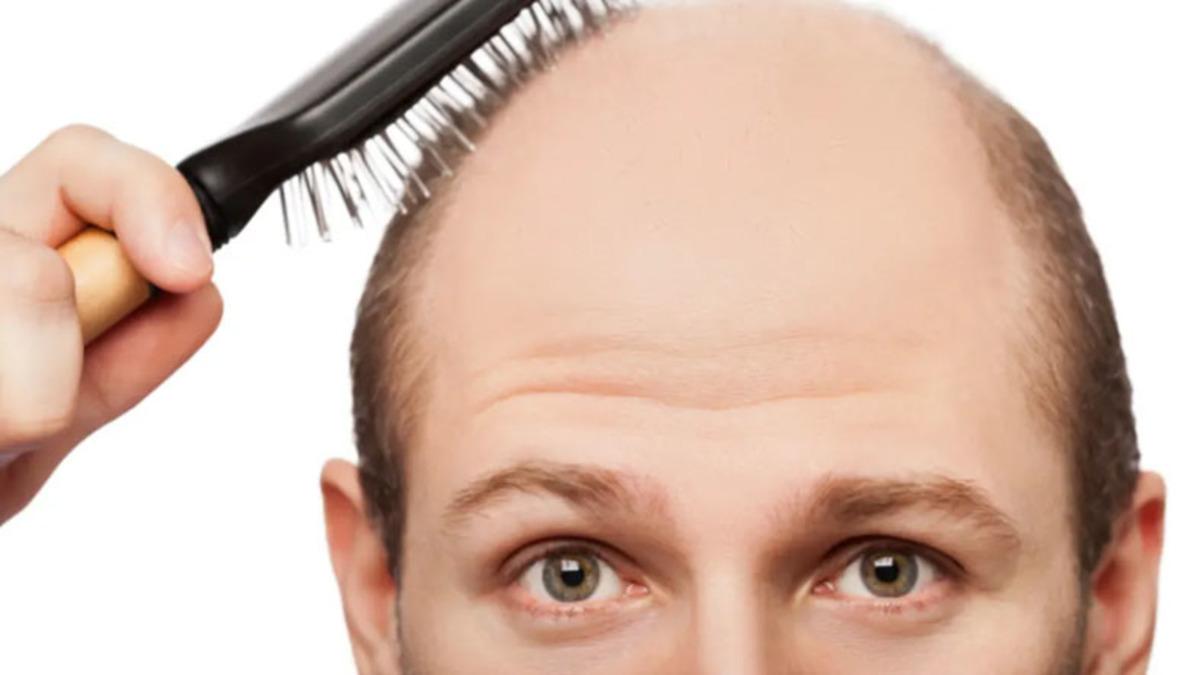 Japon Bilim İnsanları, Kelliğe Karşı Etkili Bir Çözüm Geliştirdi