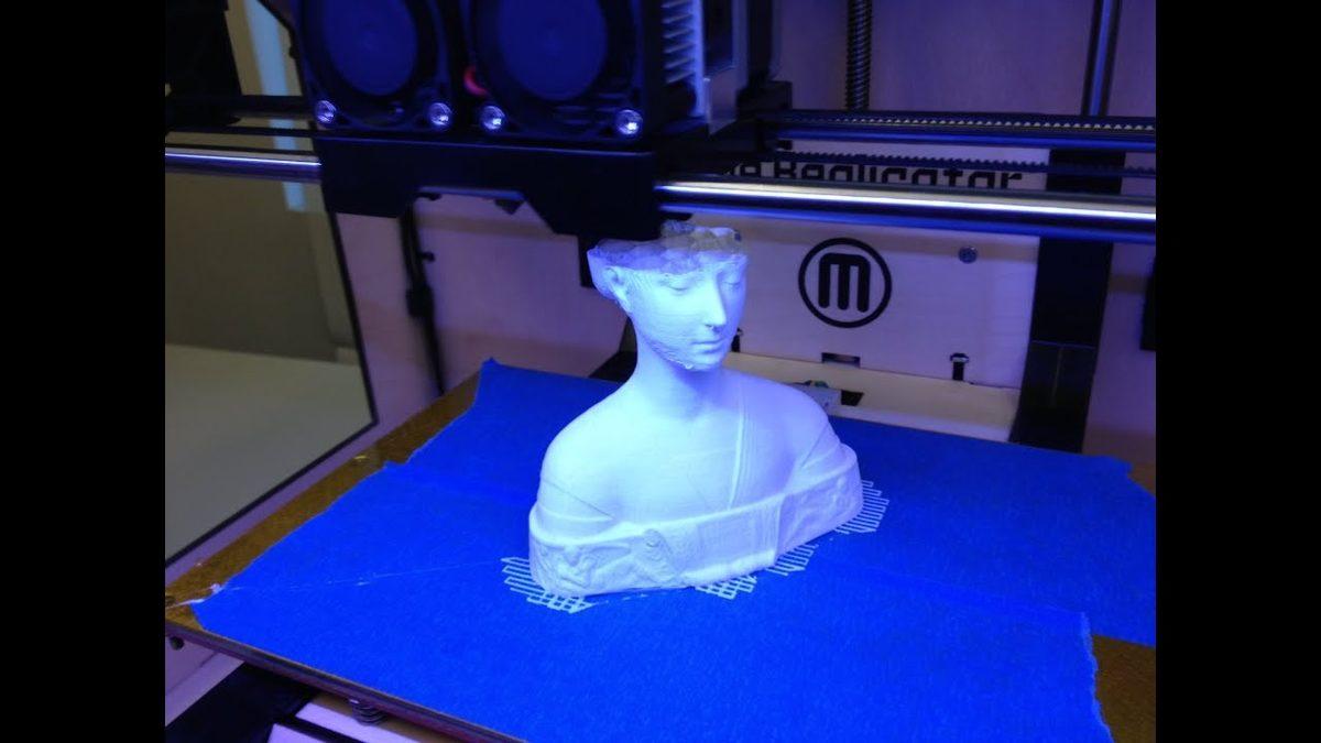 Kafatasının Yüzde 83’ü Parçalanan Adam, 3 Boyutlu Yazıcılarla Hazırlanan İmplantlar Sayesinde Eski Görüntüsüne Kavuştu