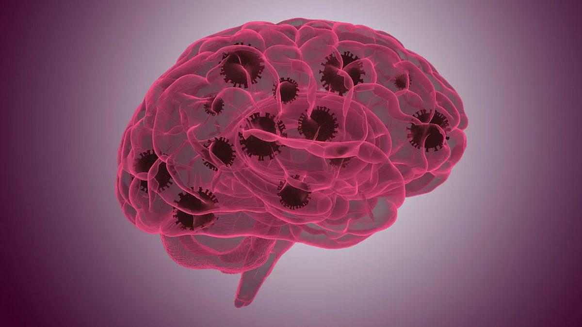 Şiddetli COVID-19’un İnsanları 20 Yıl Yaşlandırdığı Keşfedildi: IQ Ortalamasını Daha da Düşürdü!