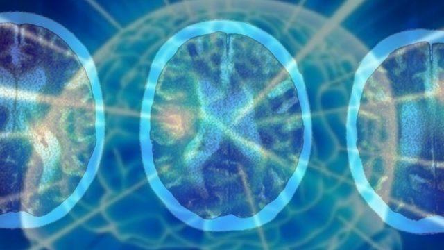 Şiddetli COVID-19’un İnsanları 20 Yıl Yaşlandırdığı Keşfedildi: IQ Ortalamasını Daha da Düşürdü!