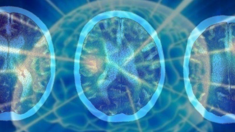 Şiddetli COVID-19’un İnsanları 20 Yıl Yaşlandırdığı Keşfedildi: IQ Ortalamasını Daha da Düşürdü!