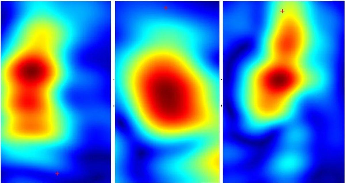 Kanserli Hücreleri Kolay ve Acısız Bir Şekilde Tespit Edebilen Cihaz Geliştirildi: Biyopsi Tarih mi Oluyor?