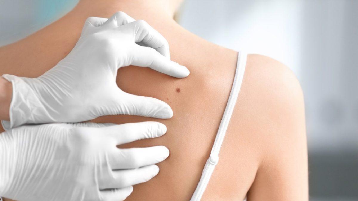 Kanserli Hücreleri Kolay ve Acısız Bir Şekilde Tespit Edebilen Cihaz Geliştirildi: Biyopsi Tarih mi Oluyor?