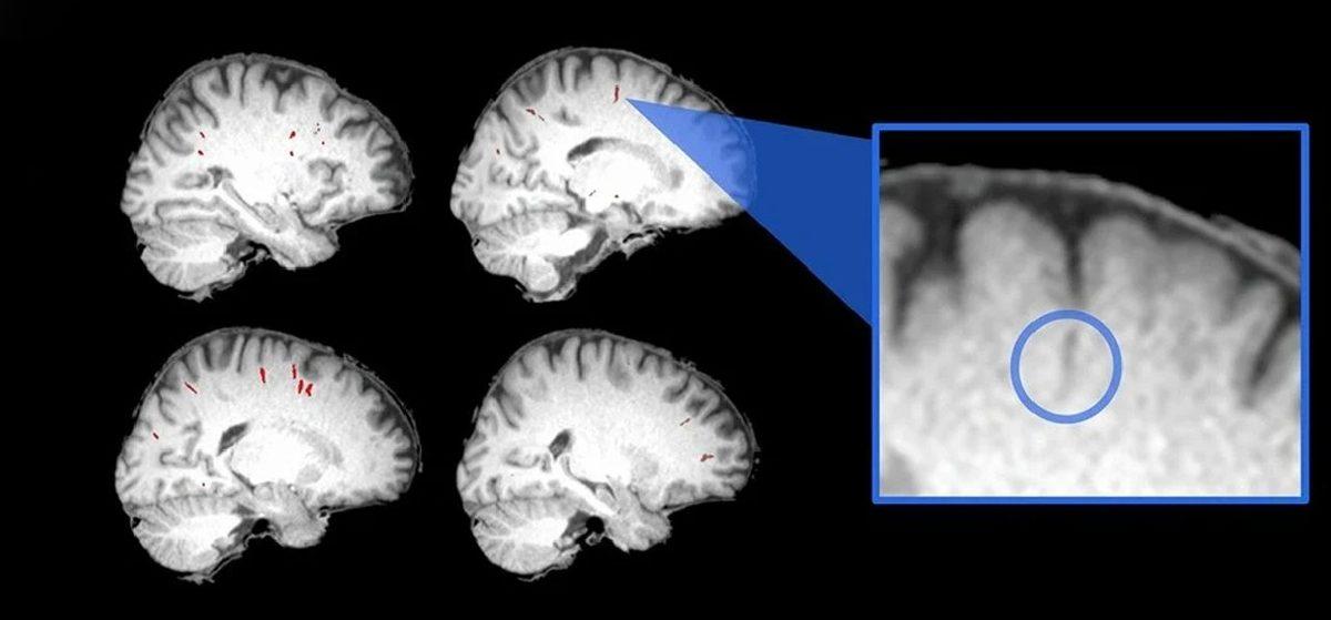 Astronotların Beyinlerinde Yaşanan Değişimlerin, Dünya’ya Döndükten Aylar Sonra Bile Devam Ettiği Tespit Edildi: Peki Bu Ne Anlama Geliyor?