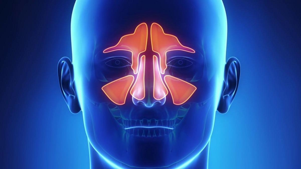 Sinüzit Nedir, Neden Olur, Sinüzite Ne İyi Gelir?