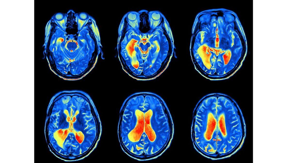 Bilim Kurgu Filmlerinde Sıkça Gördüğümüz ’Beyin Okuma’ Yakın Gelecekte Mümkün Olacak mı?