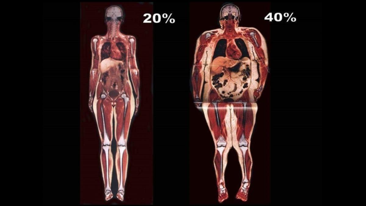 Vücudumuzda Yaktığımız Kilolarca Yağ Kütlesi Nereye, Nasıl Gider?