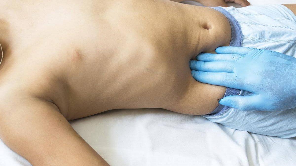 ’Apandisit’ Tam Olarak Nedir, Apandisit Rahatsızlığının Sebepleri ve Belirtileri Nelerdir?