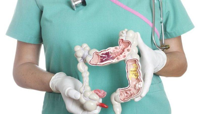 ’Apandisit’ Tam Olarak Nedir,  Apandisit Rahatsızlığının Sebepleri ve Belirtileri Nelerdir?