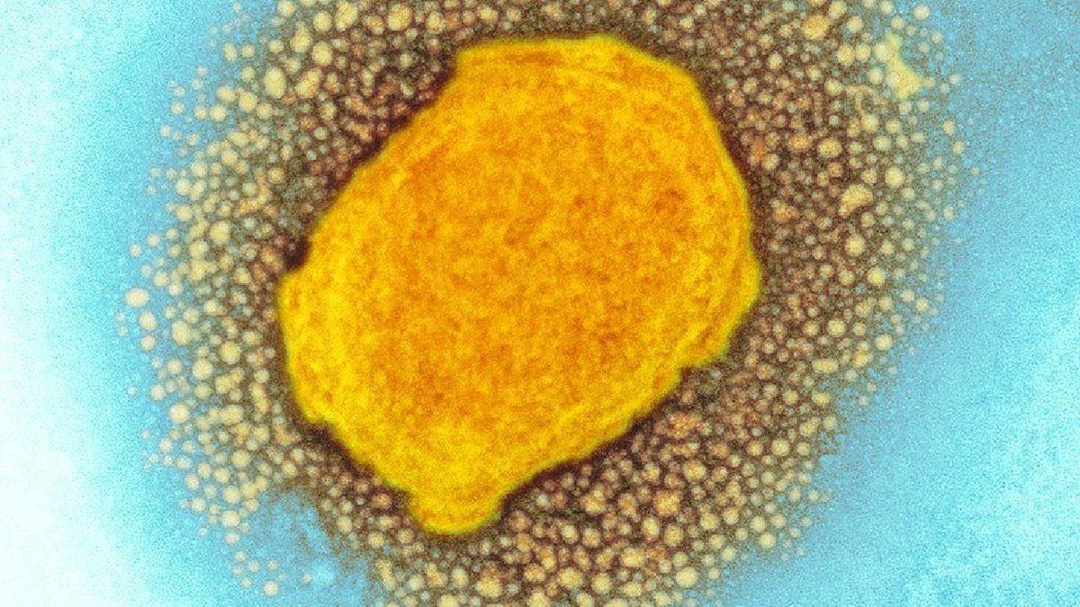 Ölümcül Sonuçları Olabilen ’Maymun Çiçeği’ Virüsü Avrupa ve ABD’de Görülmeye Başladı