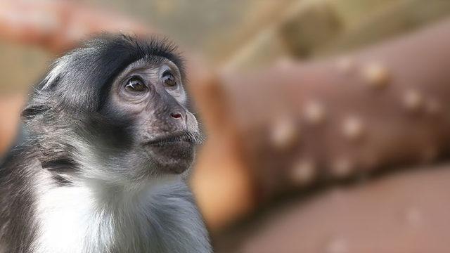 Yeni Ölümcül Salgın ’Maymun Çiçeği’ Nedir, Hangi Belirtleri Gösteriyor, Korunmak İçin Hangi Önlemler Alınmalı?
