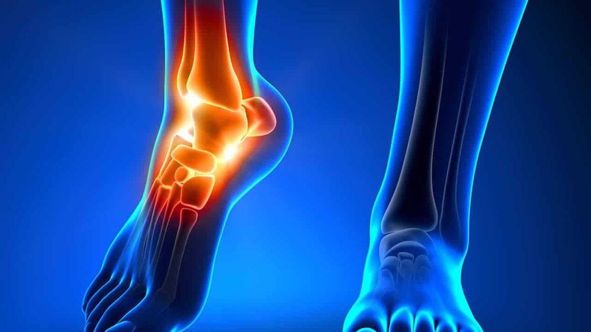 El ve Ayaklarımızdaki Karıncalanma Hissinin Bilime Göre Sebebi