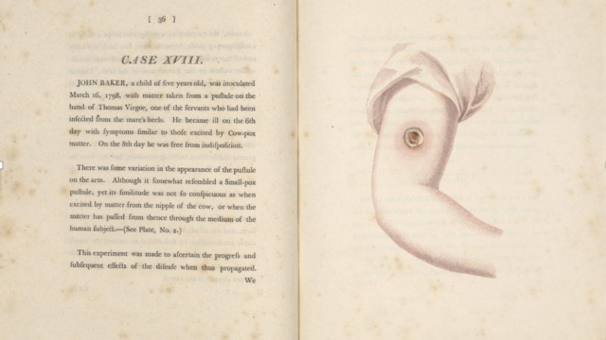 Osmanlı’da Uygulanan Çiçek Hastalığı Tedavisi Nasıl Oldu da Tüm Avrupa’yı Kurtardı?